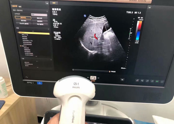La sonde d'échographie médicale abdominale Philip C5-1 pour le dispositif EPIQ 5
