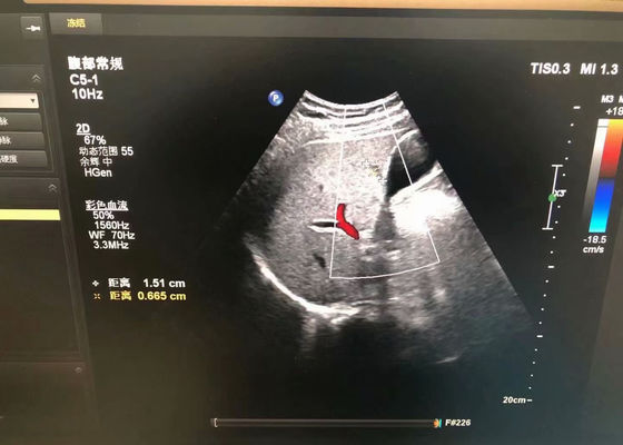 La sonde d'échographie médicale abdominale Philip C5-1 pour le dispositif EPIQ 5